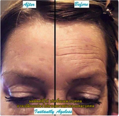 Instantly Ageless สุดยอดครีมลดถุงใต้ตา รูปที่ 4