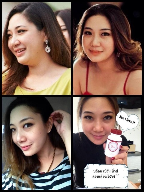 อาหารเสริมช่วยลดน้ำหนัก BBB บีบีบี รูปที่ 6