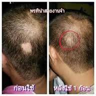 สุดยอดด้านคุณภาพและเห็นผลของ