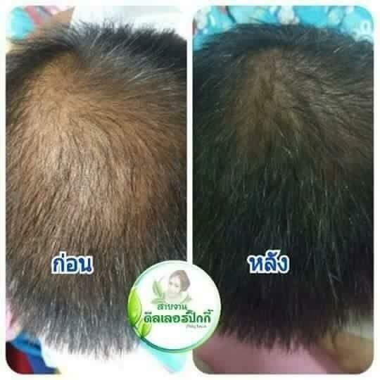 สุดยอดด้านคุณภาพและเห็นผลของ