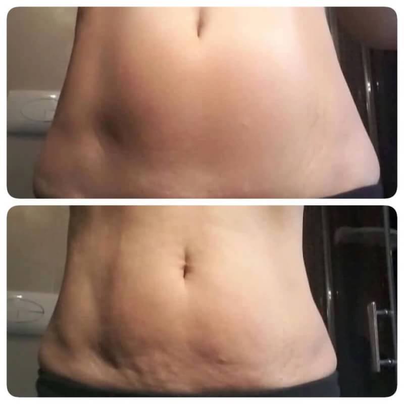 LUMINESCE ESSENTIAL BODY RENEWAL แขน ขาคุณจะเรียวเล็ก แบบไม่ต้องเจ็บตัว รูปที่ 4