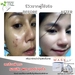 รูปย่อ Freshy face เซรั่มหน้าเด้งสูตรเร่งด่วน สวยใสเด้งเพียงข้ามคืน 99 เปอร์เซนต์ พึ่งพอใจในมาร์คหน้าเด้ง รูปที่5