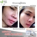 รูปย่อ Freshy face เซรั่มหน้าเด้งสูตรเร่งด่วน สวยใสเด้งเพียงข้ามคืน 99 เปอร์เซนต์ พึ่งพอใจในมาร์คหน้าเด้ง รูปที่2