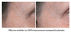 รูปย่อ Biotopix Advanced Anti-Wrinkles Treatment ลดริ้วรอย ร่องลึก เหี่ยวย่น รูปที่4