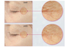 รูปย่อ Biotopix Advanced Anti-Wrinkles Treatment ลดริ้วรอย ร่องลึก เหี่ยวย่น รูปที่7