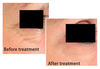 รูปย่อ Biotopix Advanced Anti-Wrinkles Treatment ลดริ้วรอย ร่องลึก เหี่ยวย่น รูปที่6