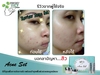 รูปย่อ เซตรักษาสิว ต้อง Acne Set Freshy Face สยบทุกปัญหาสิว เยอะแค่ไหนหายชัวร์  รูปที่1