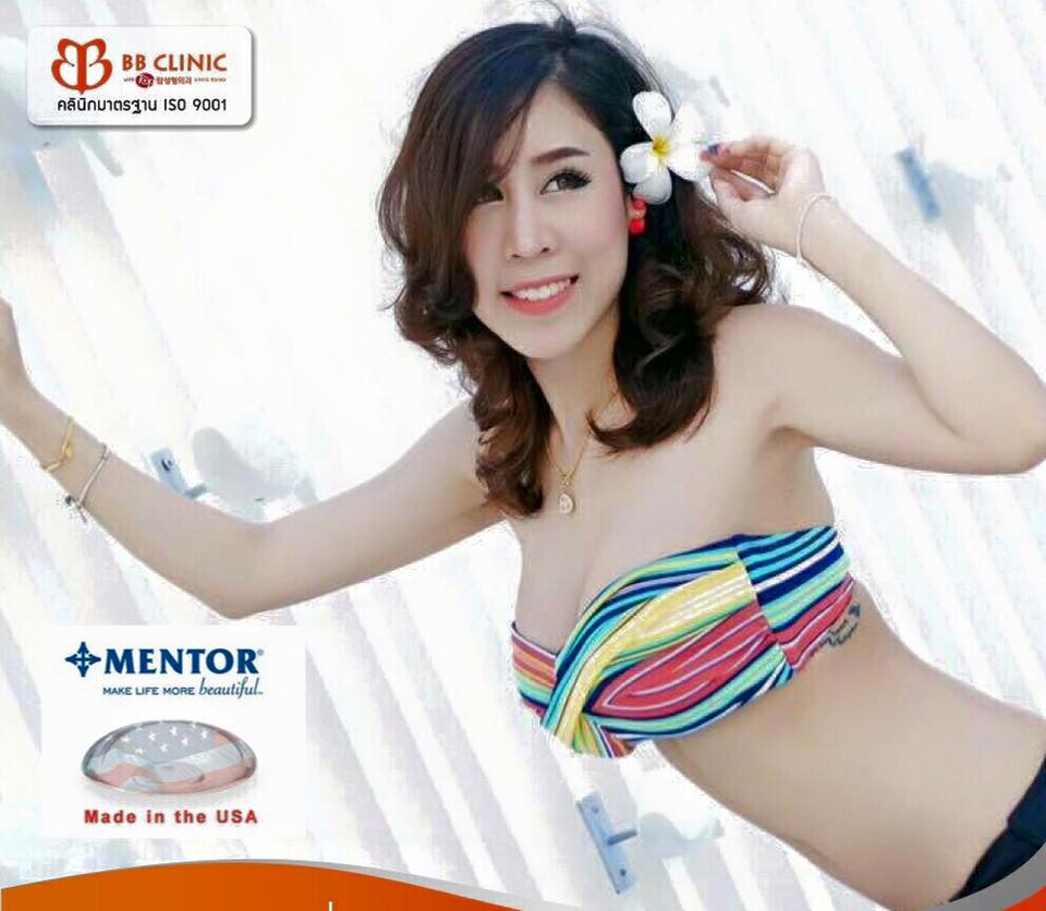 เสริมหน้าอก bb clinicติดต่อแมว(พยาบาล)0653545163 รูปที่ 8