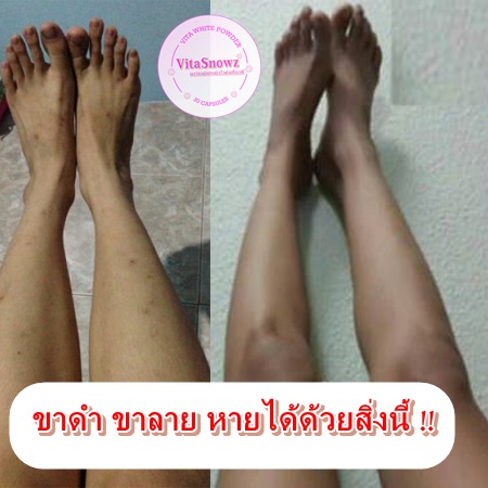 ผงเทพออร่า ช่วยเปลี่ยนการทาครีม ทาโลชั่นเดิมๆ ให้เห็นผลดีขึ้นกว่า 5 เท่า รูปที่ 6