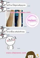 วิธีทำให้ผิวขาว แบบใหม่ ด้วยผงเทพออร่า ผงวิตามินเข้มข้นทาผิวแล้วขาวมาก ทา 5 วันรู้เรื่อง รูปที่ 5