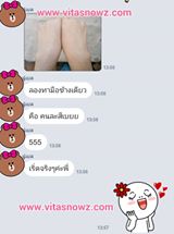 วิธีทำให้ผิวขาว แบบใหม่ ด้วยผงเทพออร่า ผงวิตามินเข้มข้นทาผิวแล้วขาวมาก ทา 5 วันรู้เรื่อง รูปที่ 4