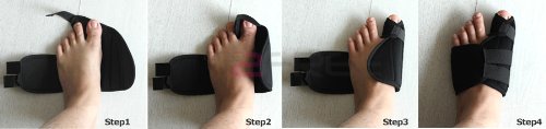 ผ้าสวมนิ้วเท้าบรรเทาอาการปวด bunions รูปที่ 5
