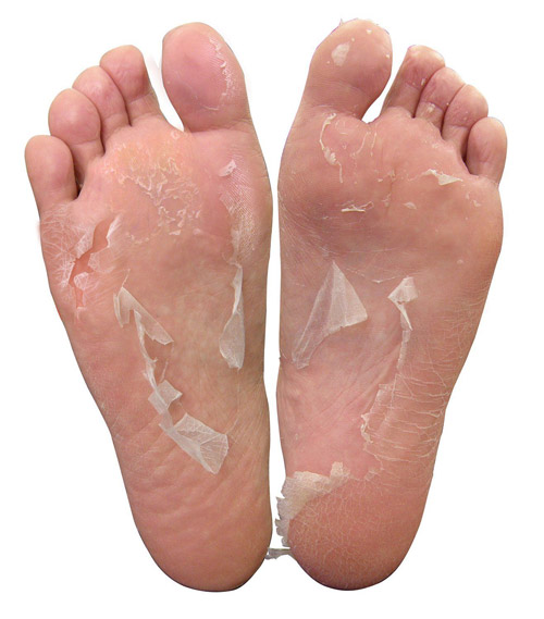 Foot Peeling Pack-Perorin ถุงลอกเท้า บำรุง กำจัดกลิ่น ส้นเท้าแตก เท้าด้าน 2 คู่ รูปที่ 1