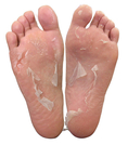 Foot Peeling Pack-Perorin ถุงลอกเท้า บำรุง กำจัดกลิ่น ส้นเท้าแตก เท้าด้าน 2 คู่