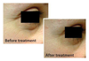 รูปย่อ Biotopix Advanced Anti-Wrinkles Treatment ลดริ้วรอย ร่องลึก เหี่ยวย่น รูปที่4
