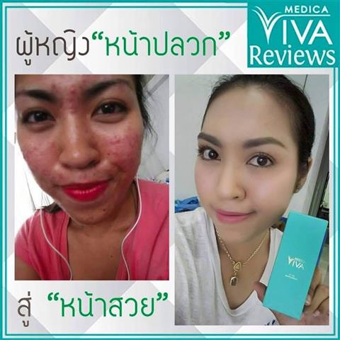 จำหน่าย เซรั่มวิว่า และครีมกันแดดวิว่า  ผิวเรียบเนียน ลดฝ้า กระ จุดด่างดำ รูปที่ 6