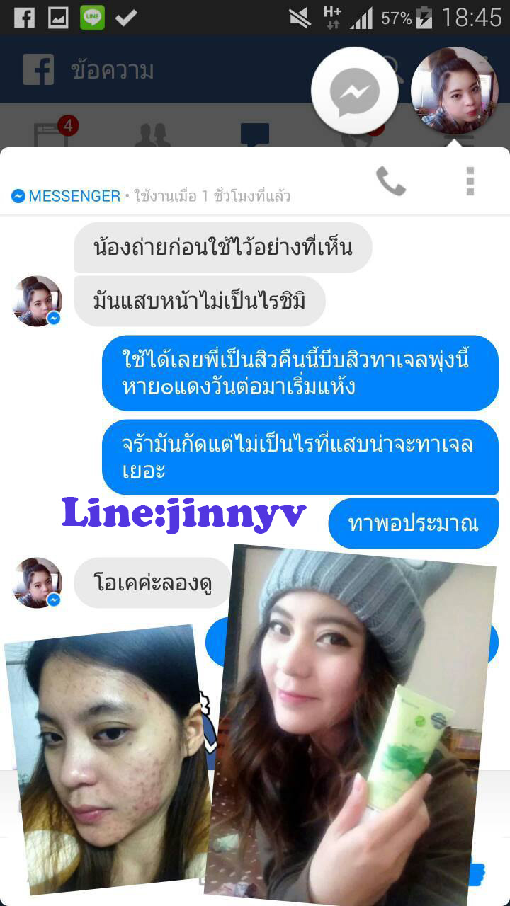 ครีมบำรุงตัวแรกที่ทุกคนต้องมี ว่านหางจระเข้แท้ 100% รูปที่ 5