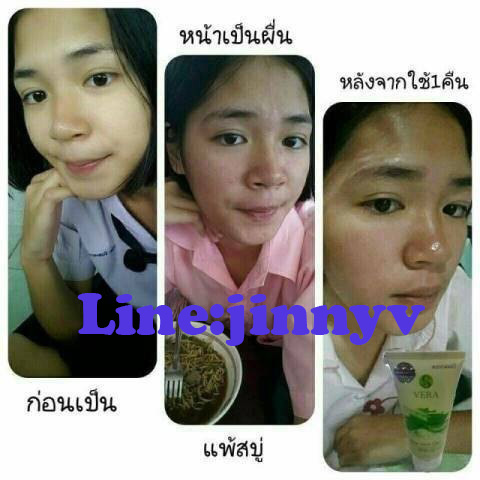 ครีมบำรุงตัวแรกที่ทุกคนต้องมี ว่านหางจระเข้แท้ 100% รูปที่ 3