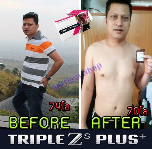 Triple Z S plus ลดน้ำหนัก กระชับสัดส่วน เห็นผลใน 7 วัน 0629655191 YA รูปที่ 1