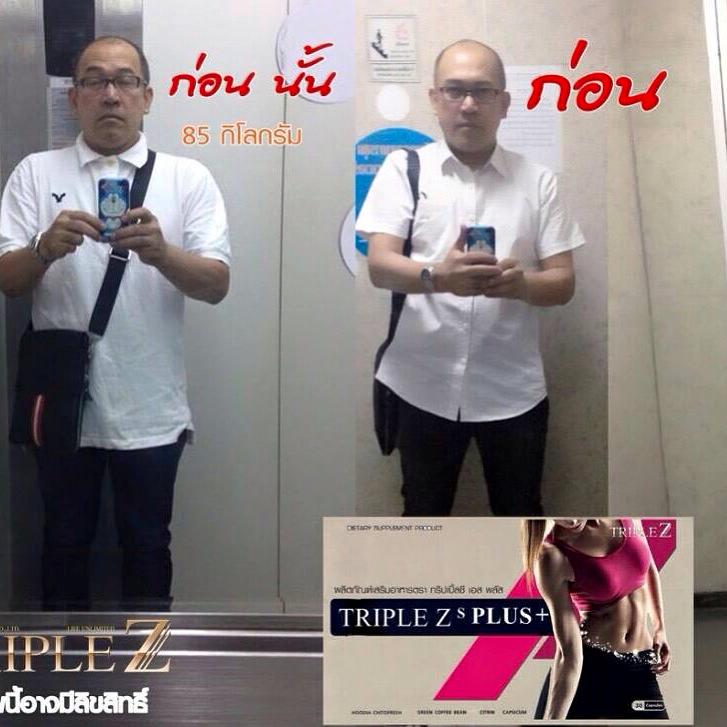 Triple zs plus  ลดน้ำหนัก ส่วนเกิน  ลด ต้นแขน ต้นขา หน้าท้อง  รูปที่ 1