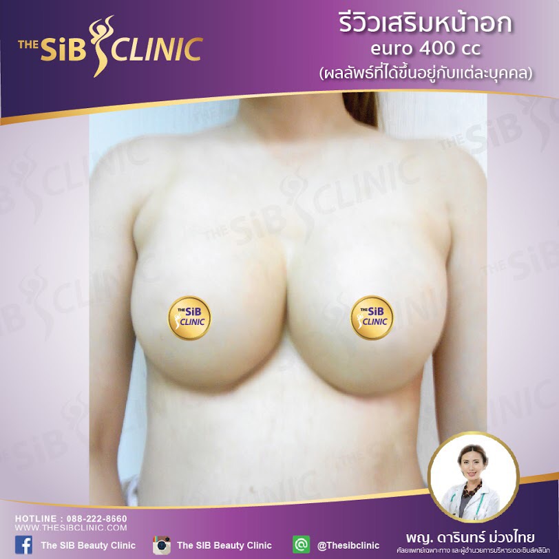 เสริมหน้าอก400cc หมอดารินทร์0924414623 รูปที่ 1