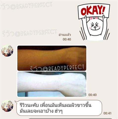 Readyperfect Medical Center ฉีดกลูต้า ฉีดผิวขาว โบท็อก เมโสแฟต ราคาถูกที่สุด รูปที่ 4