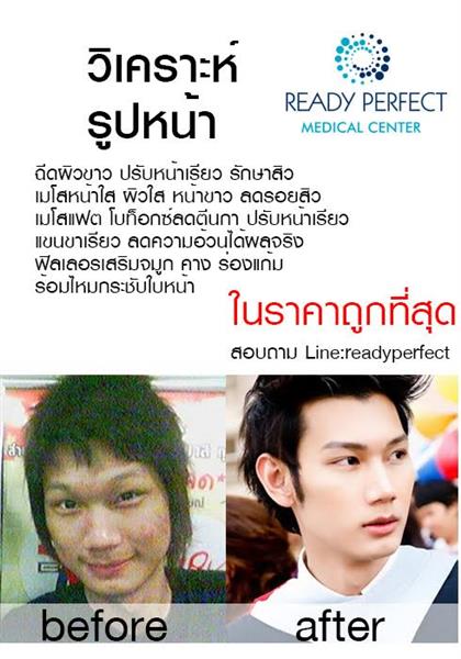 Readyperfect Medical Center ฉีดกลูต้า ฉีดผิวขาว โบท็อก เมโสแฟต ราคาถูกที่สุด รูปที่ 1