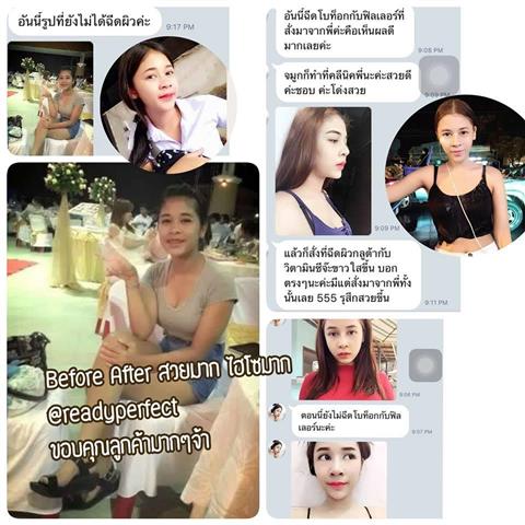 Readyperfect Medical Center ฉีดกลูต้า ฉีดผิวขาว โบท็อก เมโสแฟต ราคาถูกที่สุด รูปที่ 5