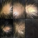 รูปย่อ Herb Hair Care เฮิร์บแฮร์แคร์ ผลิตภัณฑ์สมุนไพรปลูกผม ดูแลเส้นผมและหนังศรีษะ รูปที่4