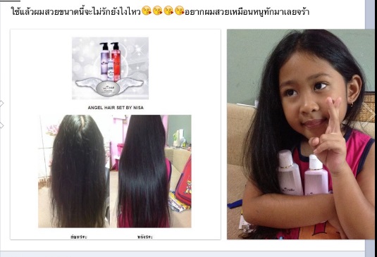 ANGEL HAIR SET BY NISAแชมพูเร่งผมยาว ที่ไม่ได้ดีแค่เร่งผมยาว ยังช่วยปรับสภาพเส้นผมเดิมให้มีสุขภาพดียิ่งขึ้น ลดผมร่วง ดูแลผมทำสี แห้งเสียให้สุขภาพดีขึ้น เพิ่มลูกผมเกิดใหม่ ทำให้หนาดกดำกว่าเดิม รูปที่ 1