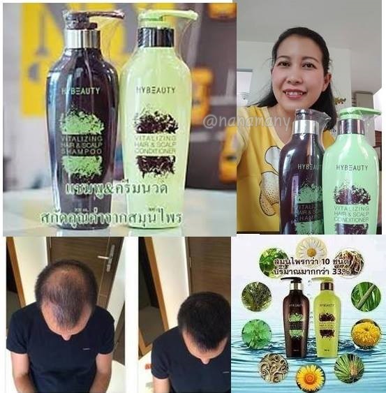 Shampoo แชมพูและครีมนวด แก้ผมบาง ผมร่วง ผมหงอก รูปที่ 1