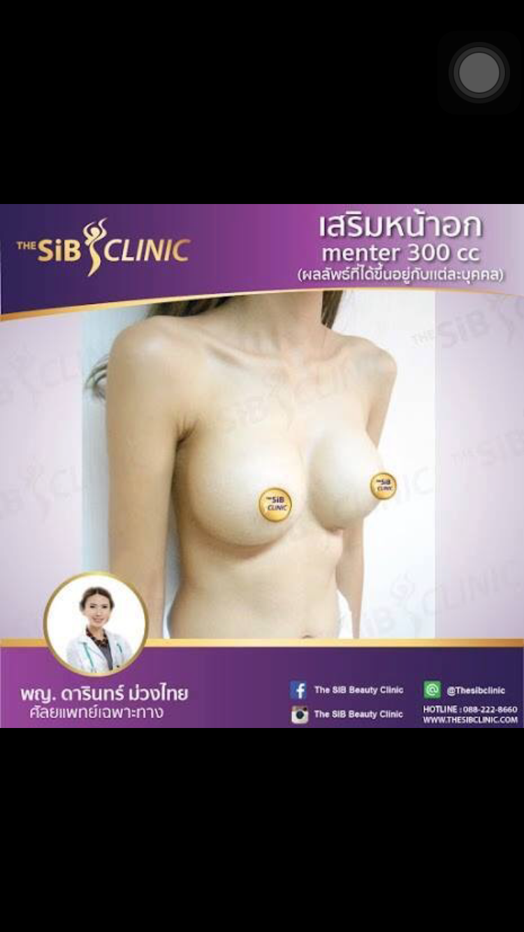 เสริมหน้าอก300cc กับหมอดารินทร์โทร 092-4414623 รูปที่ 1