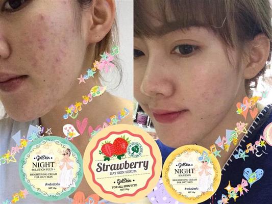 ผลิตภัณฑ์บำรุงผิวหน้า GirlSkin by FPO SkinCare มาแรงที่สุดในตอนนี้ รูปที่ 5