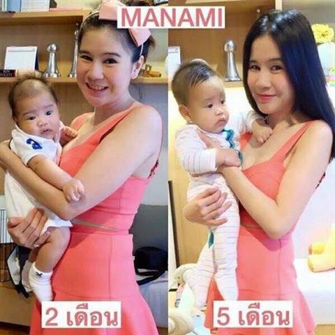 Manami ครีมสลายไขมันและกระชับสัดส่วน ขาเรียว แขนเล็กลง ปลอดภัย รูปที่ 3