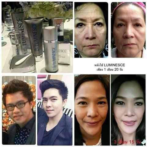 Ageless เอจเลส ผลิตภัณฑ์ลด ถุงใต้ตา ริ้วรอย ตีนกา ร่องแก้ม รอยย่นหน้าผาก รูปที่ 5