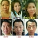 รูปย่อ Ageless เอจเลส ผลิตภัณฑ์ลด ถุงใต้ตา ริ้วรอย ตีนกา ร่องแก้ม รอยย่นหน้าผาก รูปที่6