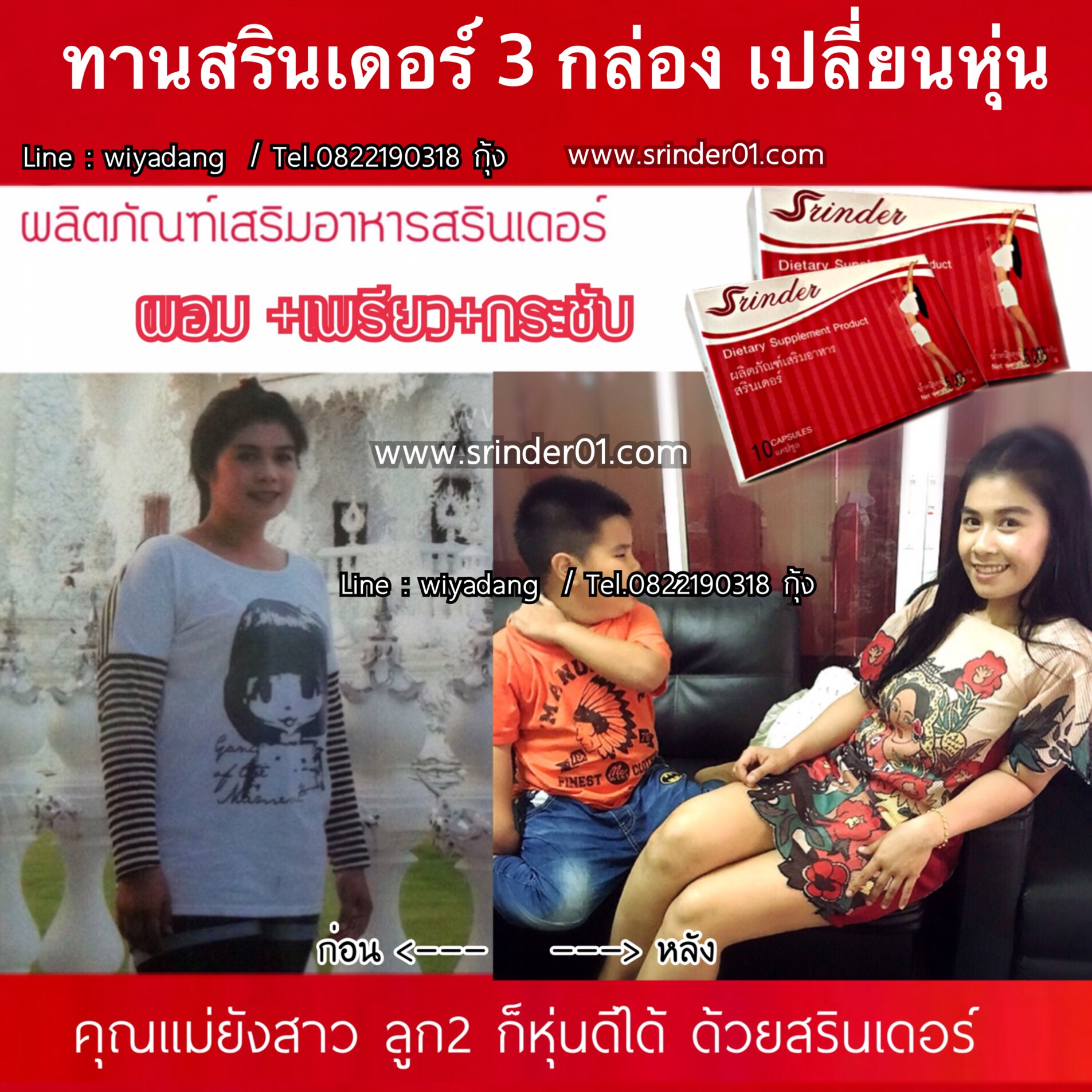 ผลิตภัณฑ์เสริมอาหารสรินเดอร์  รูปที่ 1