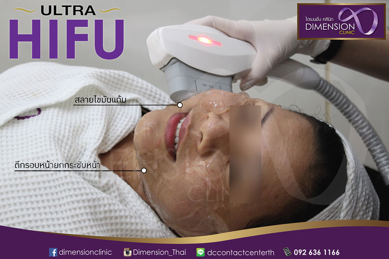 Ultra Hifu ที่ไหนดี ทั้งลดทั้งแถม ไม่จำกัดซ็อต หน้าเรียววี ยกกระชับ ไดเมนชั่นคลินิค พรอมานาด รามอินทรา รูปที่ 7