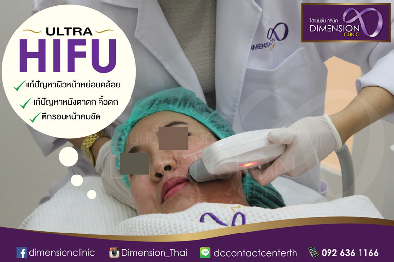 โปรโมชั่น ultra hifu ยกกระชับหน้า ไดเมนชั่นคลินิก โปรโมชั่น ยกกระชับปรับหน้าเรียว โดยไม่เจ็บ รูปที่ 6