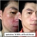 รูปย่อ เพราะอะไร LUMINESCE  จึงแตกต่างกับผลิตภัณฑ์ตามเคาน์เตอร์แบรนด์ทั่วไป รูปที่5