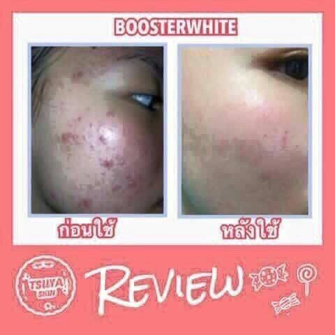 TSUYASKIN BOOSTERWHITE รูปที่ 6