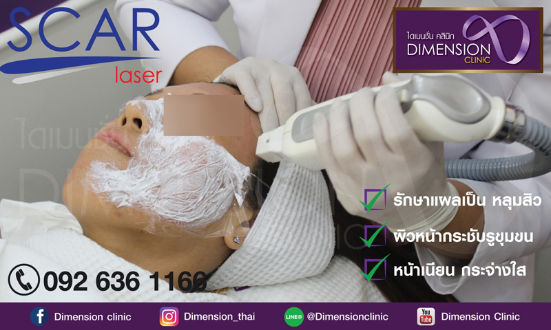 รักษาหลุมสิวคลินิก หน้าใสเด้งหลังรอยแผลเป็น หลุมสิว ผิวขรุขระ ผิวไม่เรียบหายไป รูปที่ 4