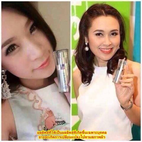 LUMINESCE ย้อนวัยผิว 5-10 ปี  มี Growth Factor  จาก StemCell มนุษย์ รูปที่ 1