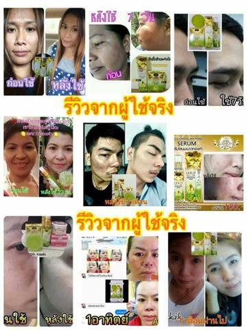 จำหน่ายผลิตภัณฑ์โสมมะนาวทองคำ  อาหารเสิรมลดน้ำหนัก MISS FIN รูปที่ 4