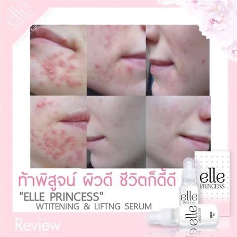 O DERMA HAIR REMOVER FOAM มูสละลายขนถนอมผิว ขจัดขนภายใน 5 นาที รูปที่ 5