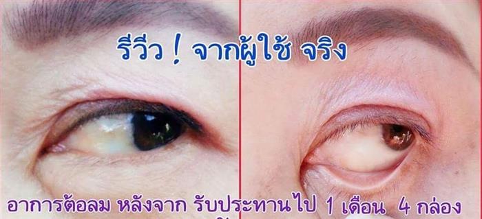 อาหารเสริมเพื่อดวงตา ดีคอนแทค D-contact ยอดขายอันดับ 1 ของเอเชีย  รูปที่ 4
