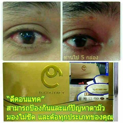 อาหารเสริมเพื่อดวงตา ดีคอนแทค D-contact ยอดขายอันดับ 1 ของเอเชีย  รูปที่ 7