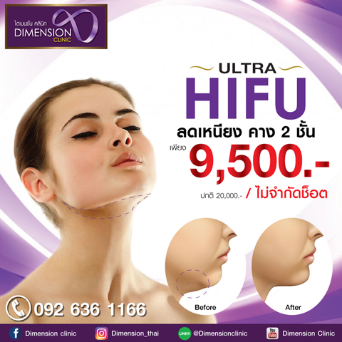 Hifu ทำที่ไหนดี ไฮฟู ราคา ไฮฟู ยกกระชับหน้าที่ไหนดี Hifu ราคาโปรโมชั่น แนะนำทีนี รูปที่ 5