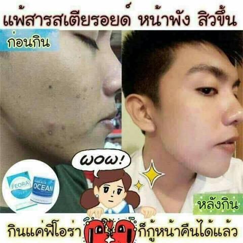 ฟีโอร่า Feora อาหารเสริมที่มาแรงที่สุด ไม่รู้จักคือพลาดอย่างแรง รูปที่ 3