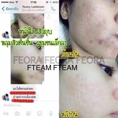ฟีโอร่า Feora อาหารเสริมที่มาแรงที่สุด ไม่รู้จักคือพลาดอย่างแรง รูปที่ 7